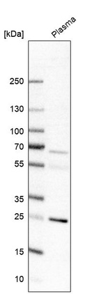 Western blot analysis in human plasma.