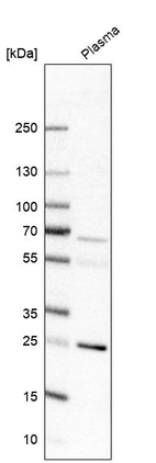 Western blot analysis in human plasma.