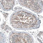 Anti-ABCC11 Antibody