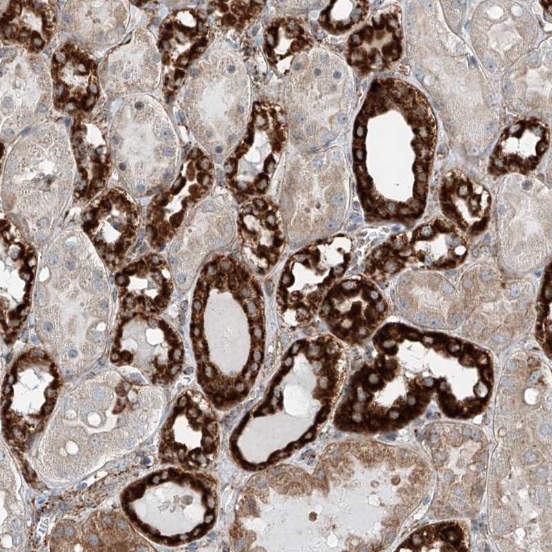 Anti-ABCC11 Antibody