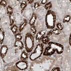 Anti-ABCC11 Antibody