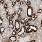 Anti-ABCC11 Antibody
