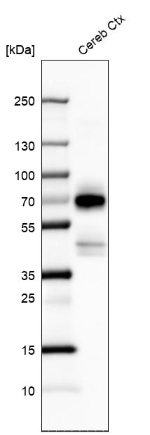 Anti-POU3F4 Antibody