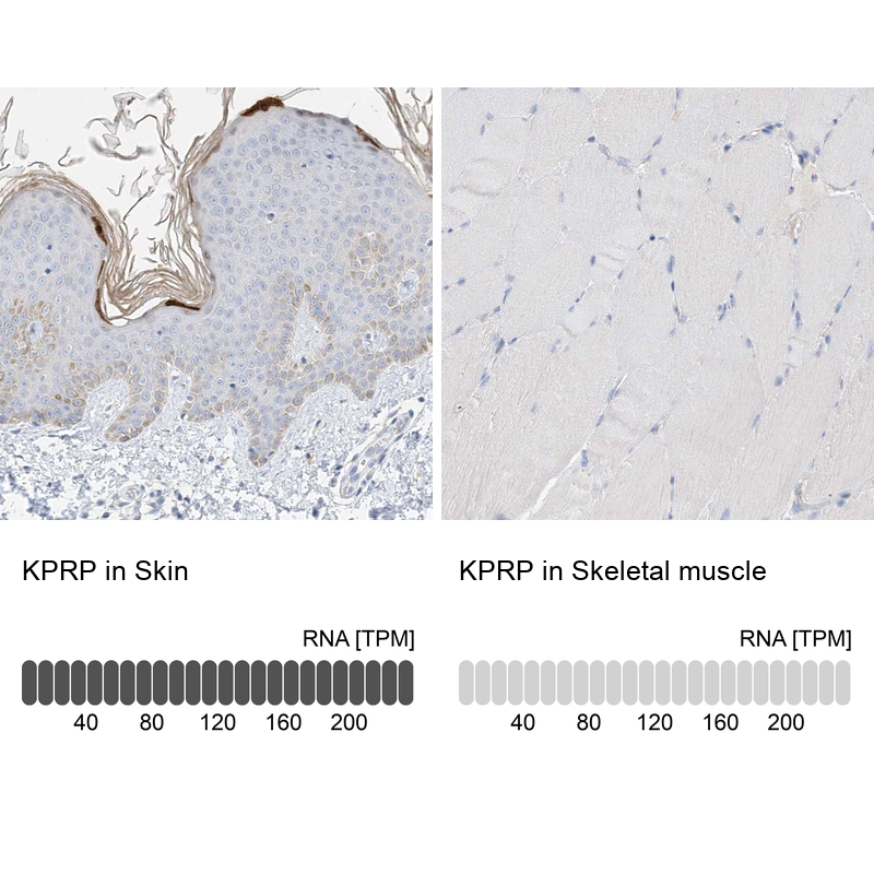 Anti-KPRP Antibody