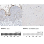 Anti-KPRP Antibody