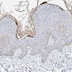 Immunohistochemical staining of human skin shows high expression.