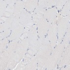 Immunohistochemical staining of human skeletal muscle shows low expression as expected.