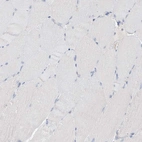 Immunohistochemical staining of human skeletal muscle shows low expression as expected.