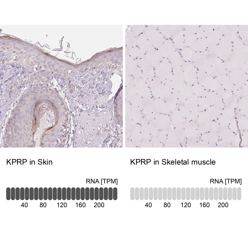 Anti-KPRP Antibody