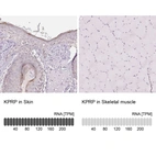 Anti-KPRP Antibody