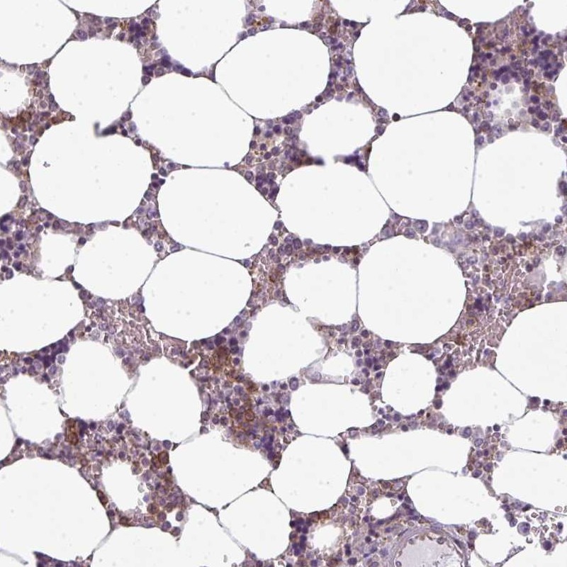 Anti-CXCR1 Antibody