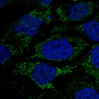 Immunofluorescent staining of human cell line CACO-2 shows localization to mitochondria.