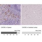 Anti-CXCR2 Antibody