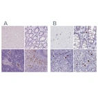 Immunohistochemical staining of human cerebral cortex, colon, lymph node and spleen using Anti-CXCR2 antibody HPA031999 (A) shows similar protein distribution across tissues to independent antibody HPA032017 (B).