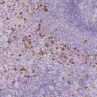 Immunohistochemical staining of human spleen shows strong cytoplasmic positivity in non-germinal center cells.