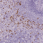 Anti-CXCR2 Antibody