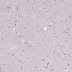 Immunohistochemical staining of human cerebral cortex shows no positivity in neurons as expected.