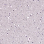 Immunohistochemical staining of human cerebral cortex shows no positivity in neurons as expected.