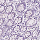 Immunohistochemical staining of human colon shows no positivity in glandular cells as expected.