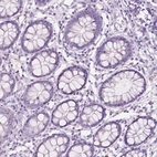 Immunohistochemical staining of human colon shows no positivity in glandular cells as expected.