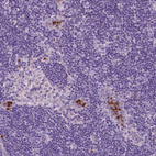 Immunohistochemical staining of human lymph node shows strong cytoplasmic positivity in non-germinal center cells.