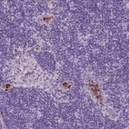 Immunohistochemical staining of human lymph node shows strong cytoplasmic positivity in non-germinal center cells.