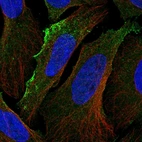 Immunofluorescent staining of human cell line U-2 OS shows localization to plasma membrane & vesicles.