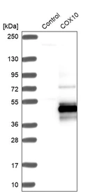 Western blot analysis in control (vector only transfected HEK293T lysate) and COX10 over-expression lysate (Co-expressed with a C-terminal myc-DDK tag (~3.1 kDa) in mammalian HEK293T cells, LY420021).