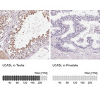 Anti-LCA5L Antibody