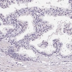 Immunohistochemical staining of human prostate shows low expression as expected.
