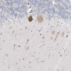Anti-ICMT Antibody