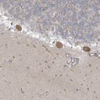 Anti-ICMT Antibody