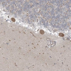 Anti-ICMT Antibody