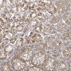 Immunohistochemical staining of human stomach shows moderate cytoplasm granular positivity in glandular cells.