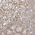 Immunohistochemical staining of human stomach shows moderate cytoplasm granular positivity in glandular cells.