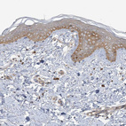 Immunohistochemical staining of human skin shows moderate cytoplasm granular positivity in squamous epithelial cells.