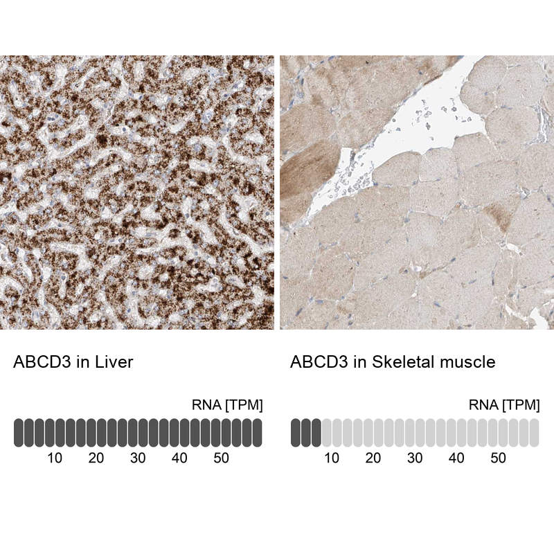 Anti-ABCD3 Antibody