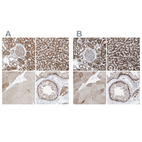Immunohistochemical staining of human kidney, liver, skeletal muscle and testis using Anti-ABCD3 antibody HPA032026 (A) shows similar protein distribution across tissues to independent antibody HPA032027 (B).