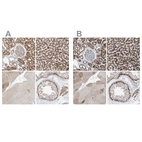Immunohistochemical staining of human kidney, liver, skeletal muscle and testis using Anti-ABCD3 antibody HPA032026 (A) shows similar protein distribution across tissues to independent antibody HPA032027 (B).