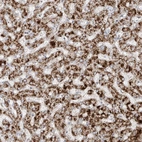Immunohistochemical staining of human liver shows strong granular cytoplasmic positivity in hepatocytes.