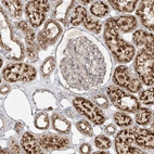 Immunohistochemical staining of human kidney shows strong granular cytoplasmic positivity in cells in tubules.