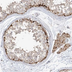 Immunohistochemical staining of human testis shows strong granular cytoplasmic positivity in cells in seminiferous ducts.