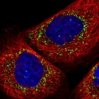 Immunofluorescent staining of human cell line A-431 shows localization to vesicles.