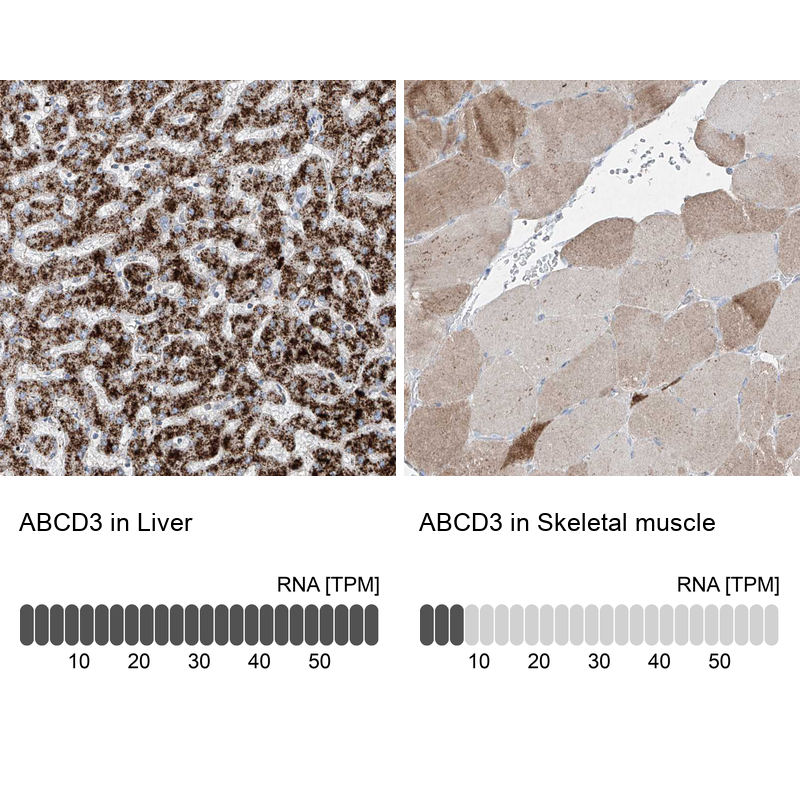 Anti-ABCD3 Antibody