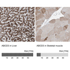 Anti-ABCD3 Antibody