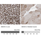 Anti-ABCD3 Antibody