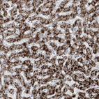 Anti-ABCD3 Antibody