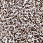 Immunohistochemical staining of human liver shows strong granular cytoplasmic positivity in hepatocytes.