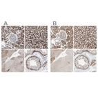 Immunohistochemical staining of human kidney, liver, skeletal muscle and testis using Anti-ABCD3 antibody HPA032027 (A) shows similar protein distribution across tissues to independent antibody HPA032026 (B).