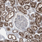 Immunohistochemical staining of human kidney shows strong granular cytoplasmic positivity in cells in tubules.